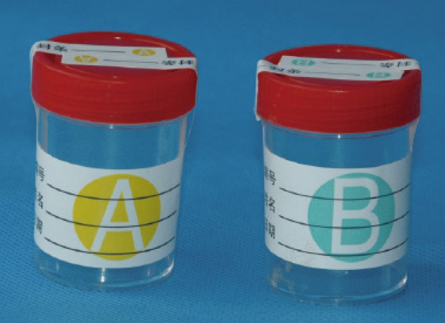 尿液包装AB瓶及标签(No.L065) 价格：￥3.00元/套